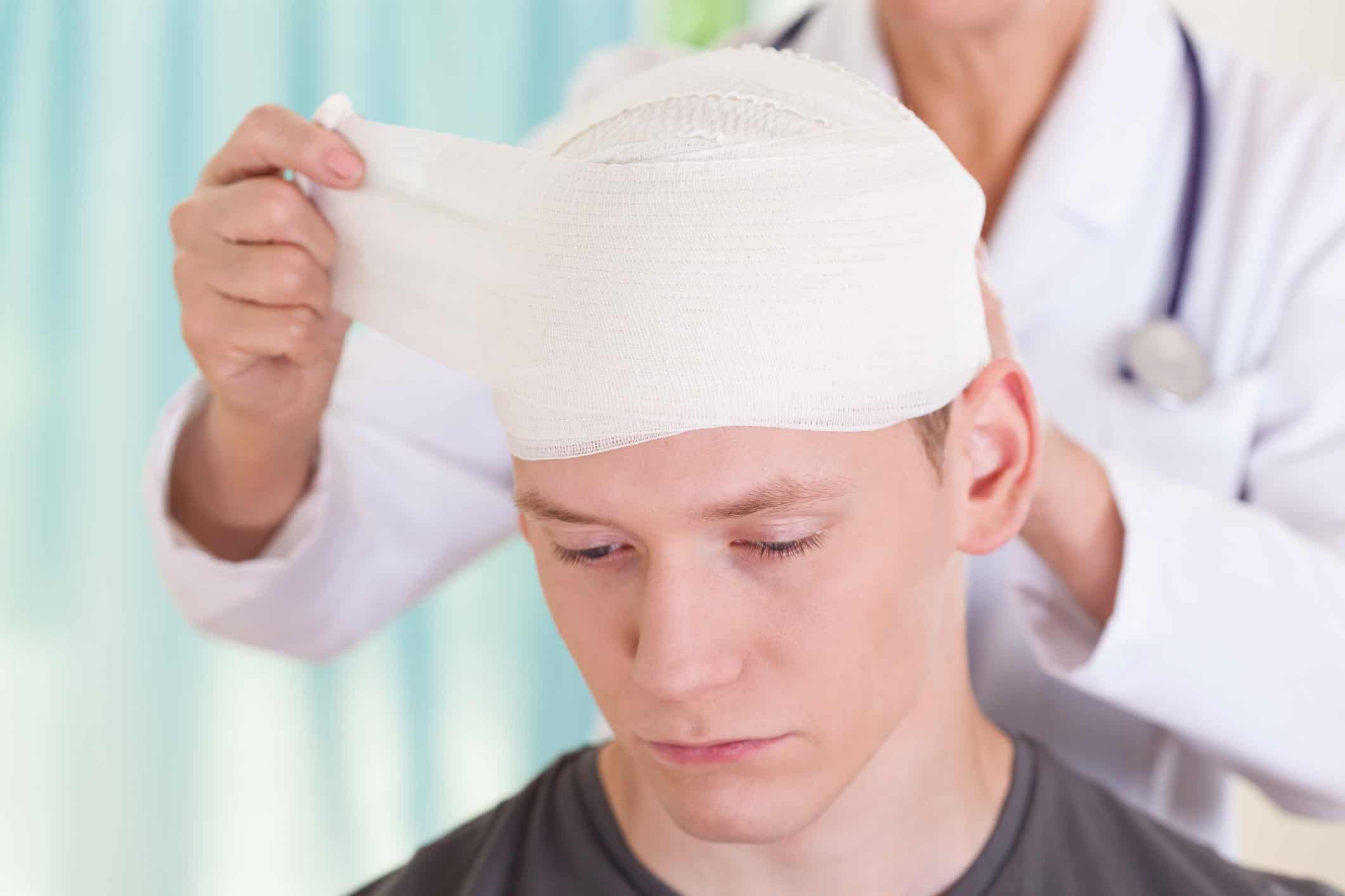 head trauma 1