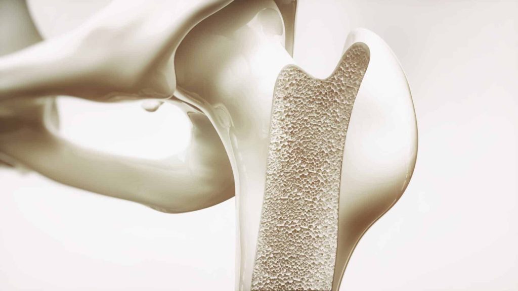 Calcium Deficiency in Seniors: Important Information You Need to Know 18 Calcium deficiency