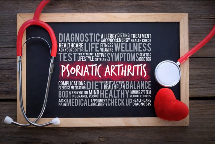 Psoriatic Arthritis