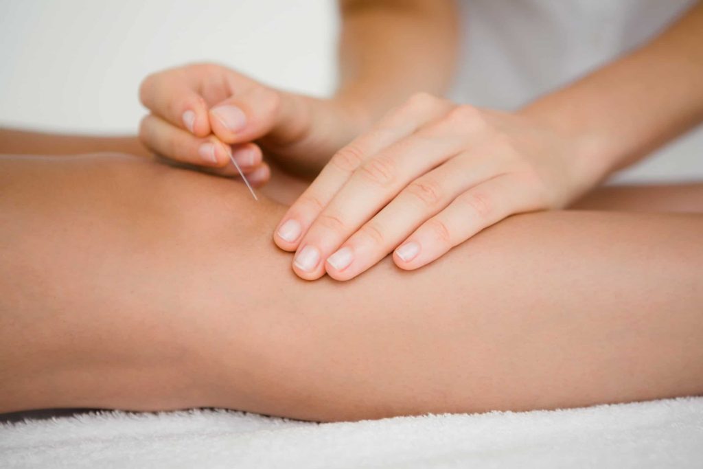 acupuncture for knee pain