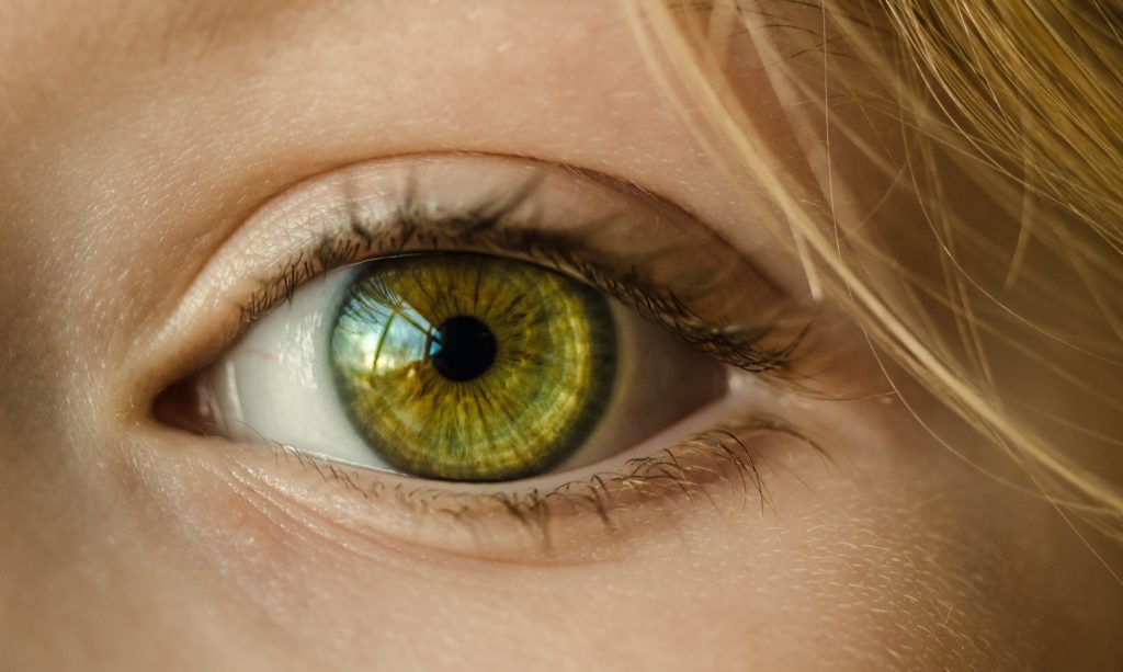 glaucoma