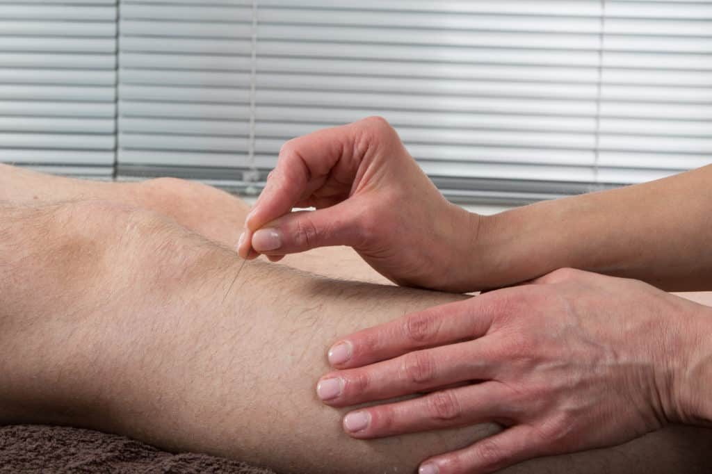 knee acupuncture